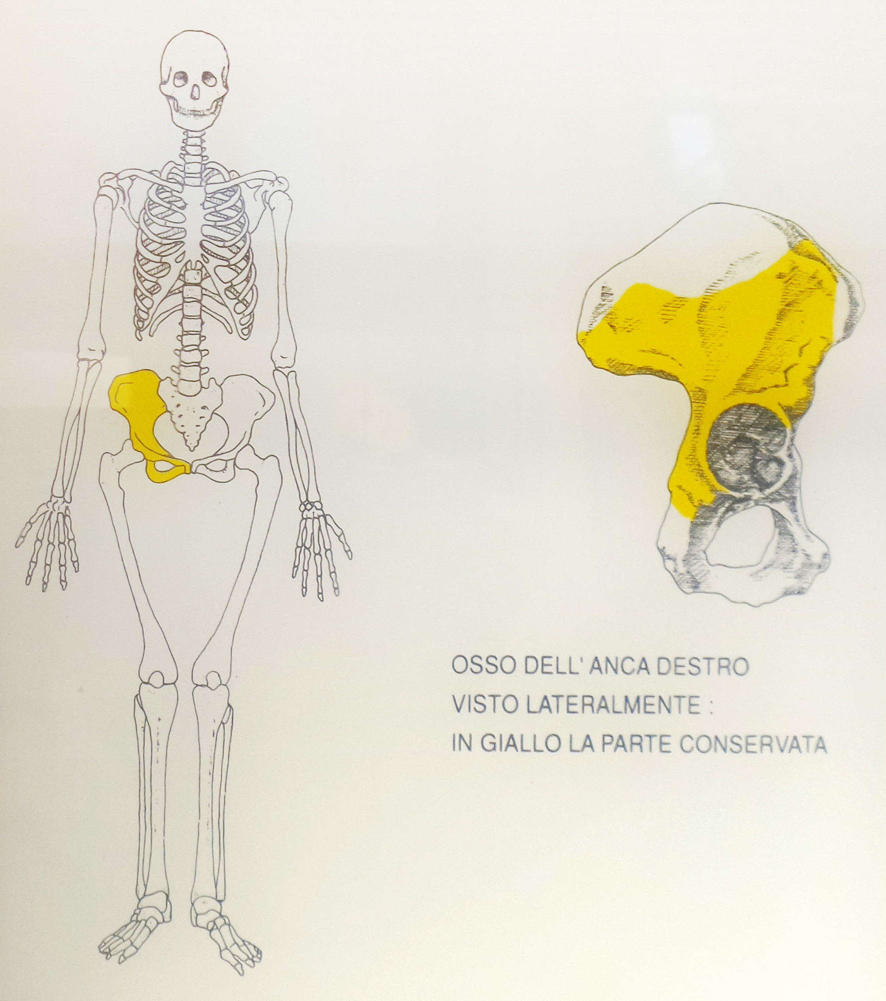 OSSO ILIACO 240K ANNI FA 2