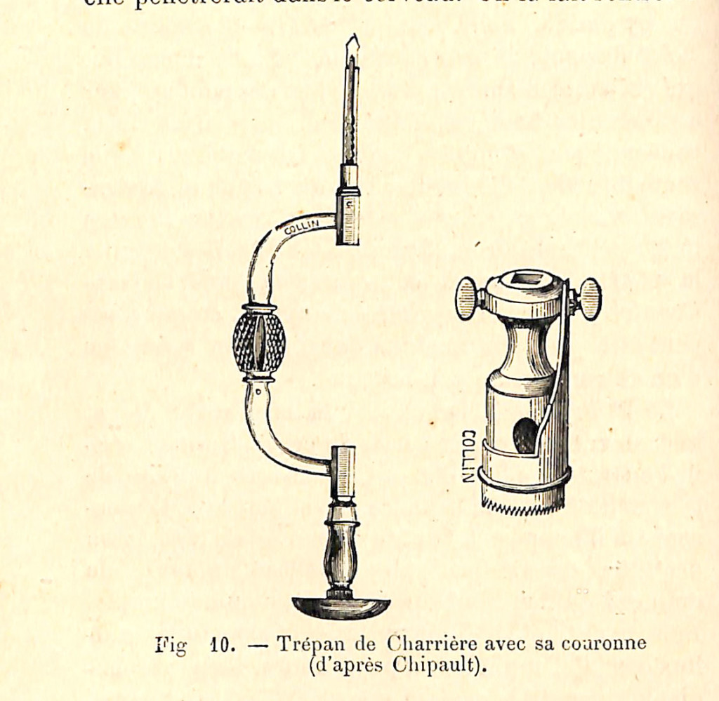 fig 010