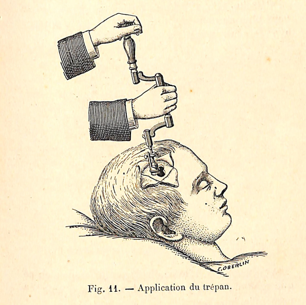 fig 011