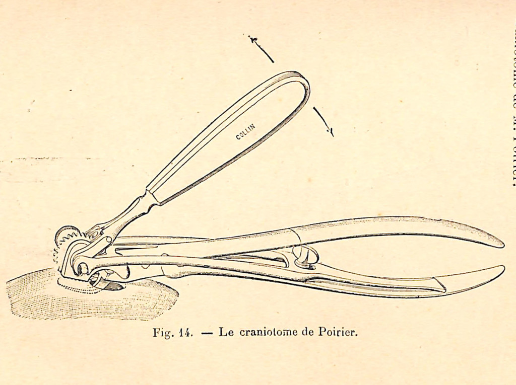 fig 014