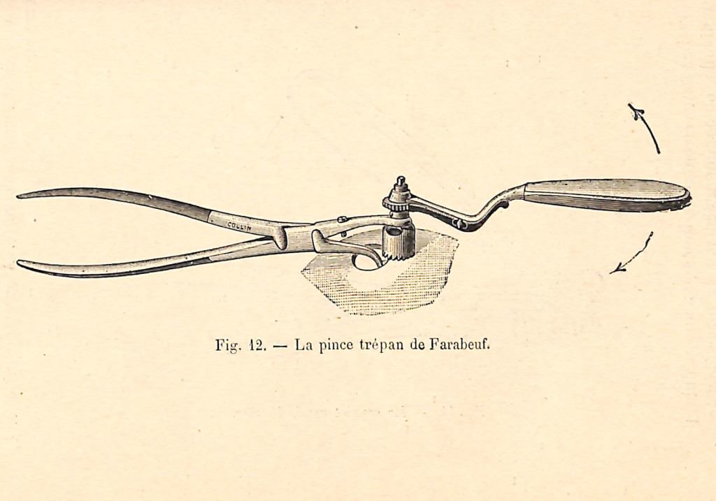 fig 015